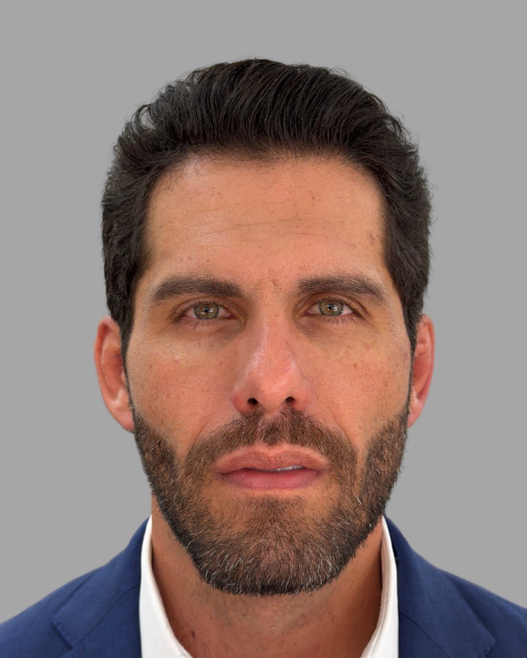 Depois — caso 1